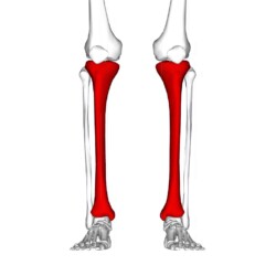 scheenbeen - shin splints - pijnljke scheenbenen