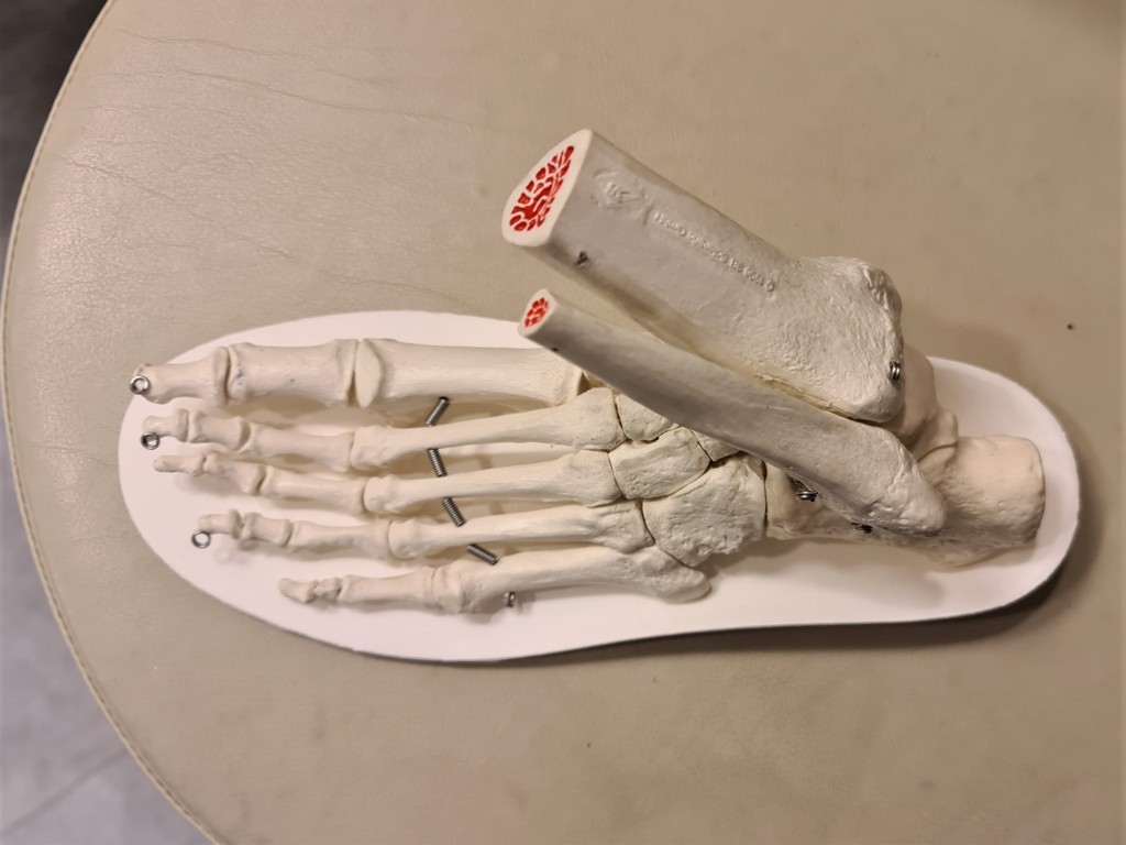 voetklachten uitgelegd met voetmodel van botten.